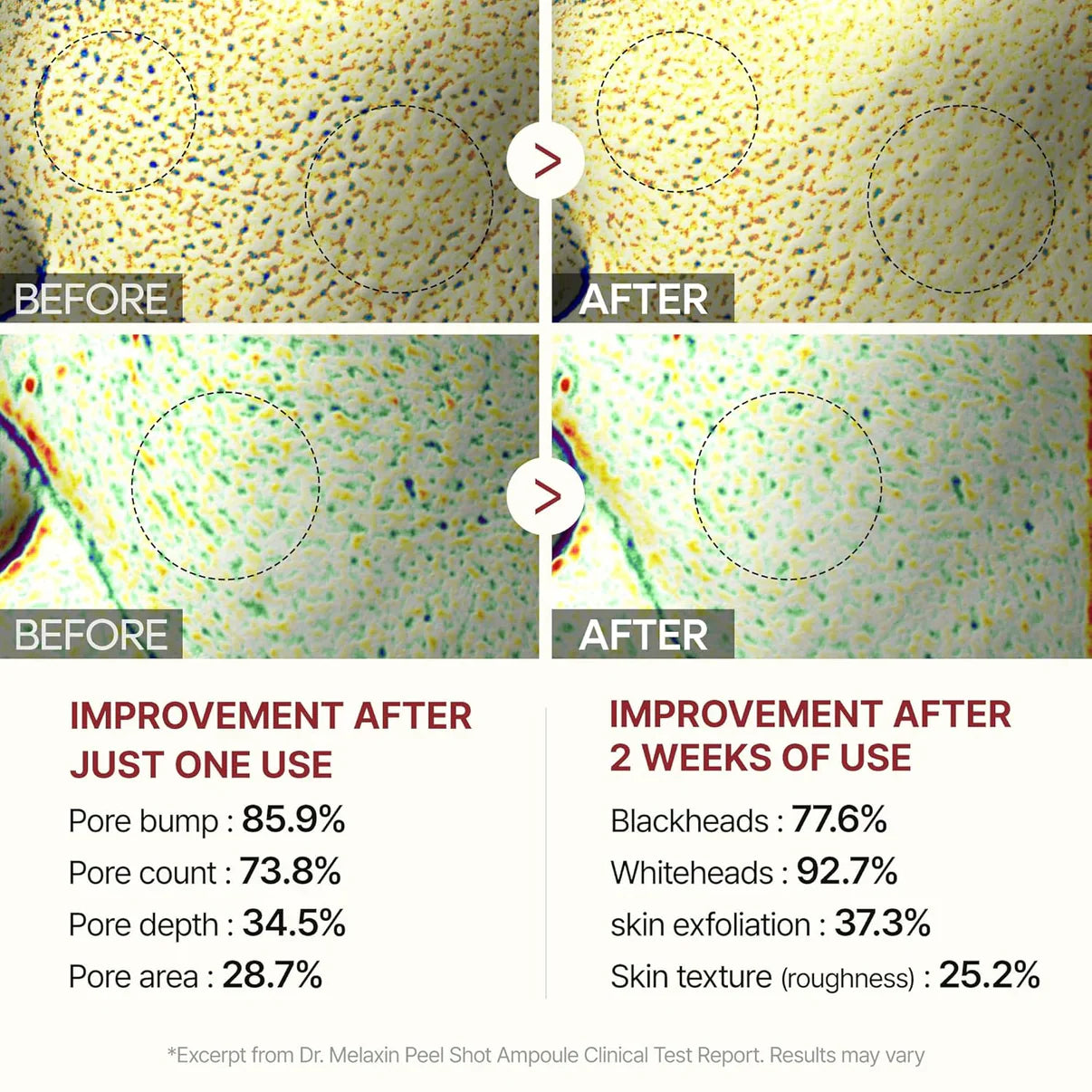 Radiant Rice Peel™